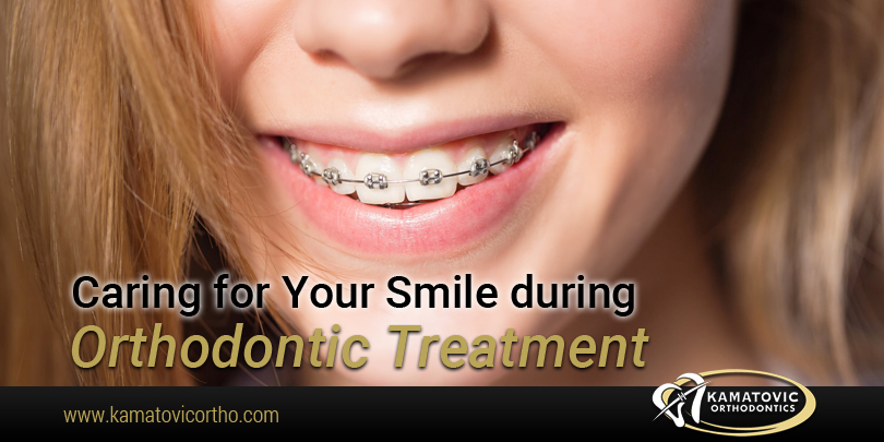 Caring For Your Smile During Orthodontic Treatment Kamatovic
